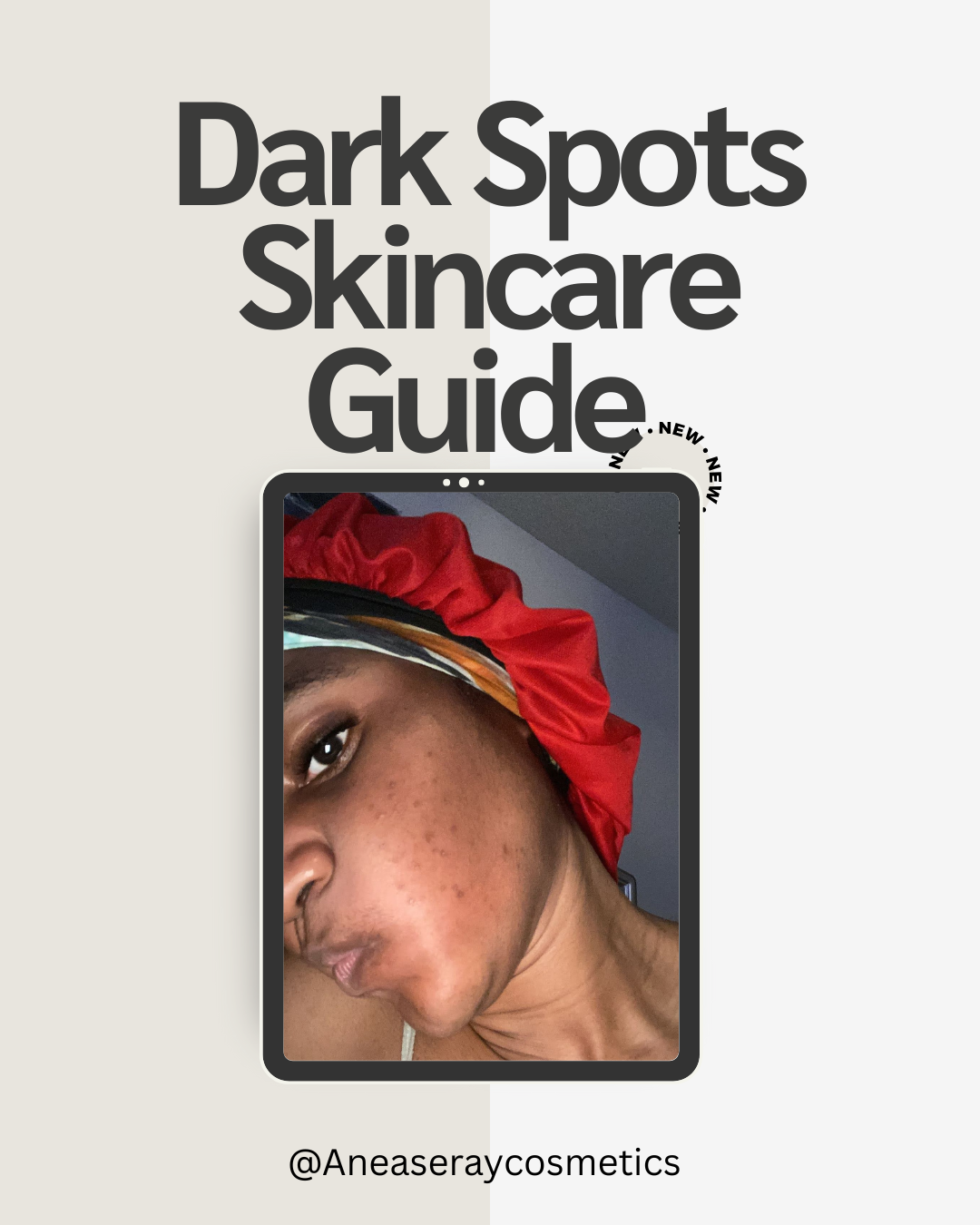 Dark Spots Skincare Guide